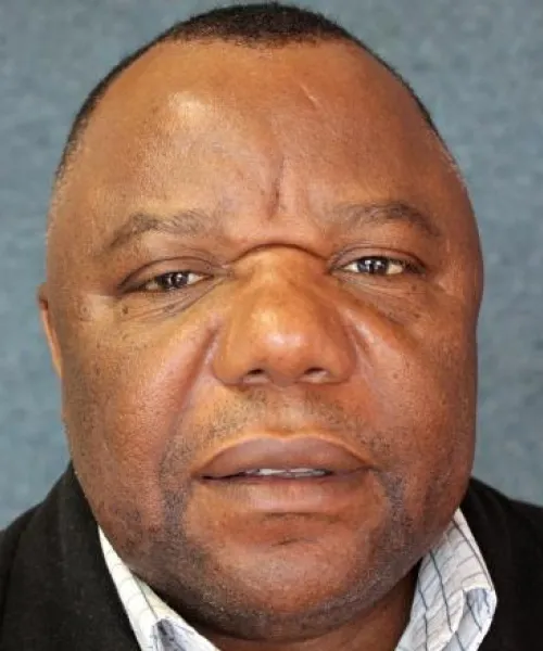 Prof. Nsalambi Nkongolo